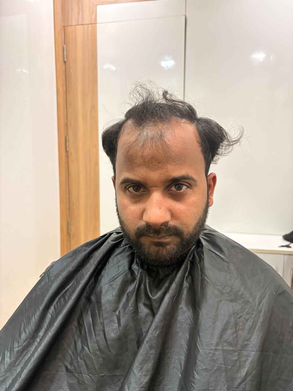 Before Treatment